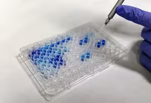 West Nile Compac, Elisa kit